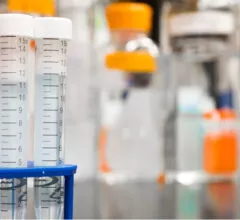 At-Home DNA Testing Kits: Just a Fancy Novelty?